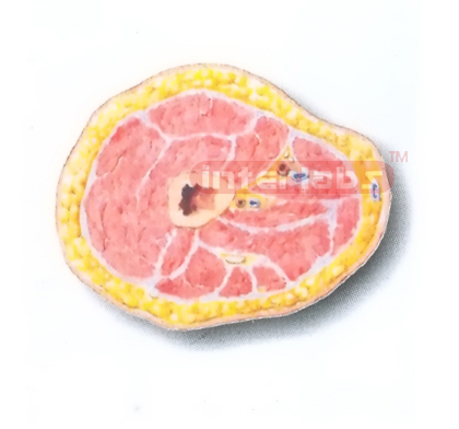 HUMAN TRANSVERSE SECTION MODEL THROUGH THE PROXIMAL 1/3 OF THE RIGHT THIGH (B)